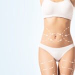 Why the Best Doctors in Dubai Recommend Fat Transfer for Natural Results