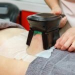 Freeze Fat, Not Confidence: Non-Invasive Fat Reduction That Works