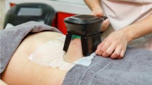 Freeze Fat, Not Confidence: Non-Invasive Fat Reduction That Works