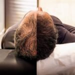 Bring Back Your Confidence with Hair Transplant in Islamabad