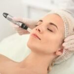 Rejuvenate Your Skin with Handa Aesthetics’ Advanced Microneedling Treatment in Delhi