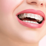 Why Choose Islamabad for Your Smile Transformation