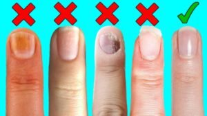 Support Nail Health: Tips for Strong and Healthy Nails