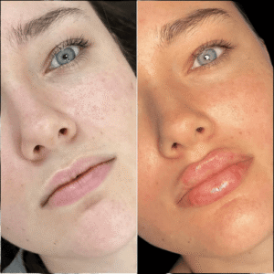 Trusted and Experienced: Best Doctors in Dubai for Fillers