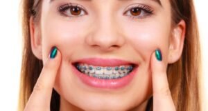 Are Braces the Right Choice for Your Smile?