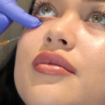 Expert Under Eye Fillers in Islamabad