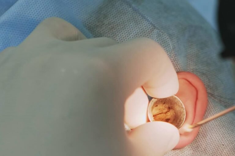 Precision Ear Reconstruction