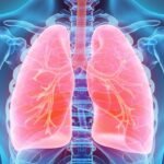 Improve Lung Health Naturally and Effectively