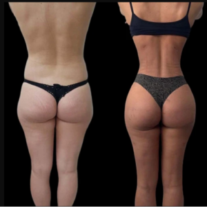 Choosing the Best Clinic for J-Plasma Treatments in Dubai