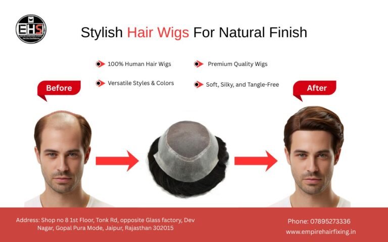 Hair Patch Jaipur: Your Local Hair Restoration Solution