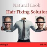 Top Benefits of Hair Replacement in 2026
