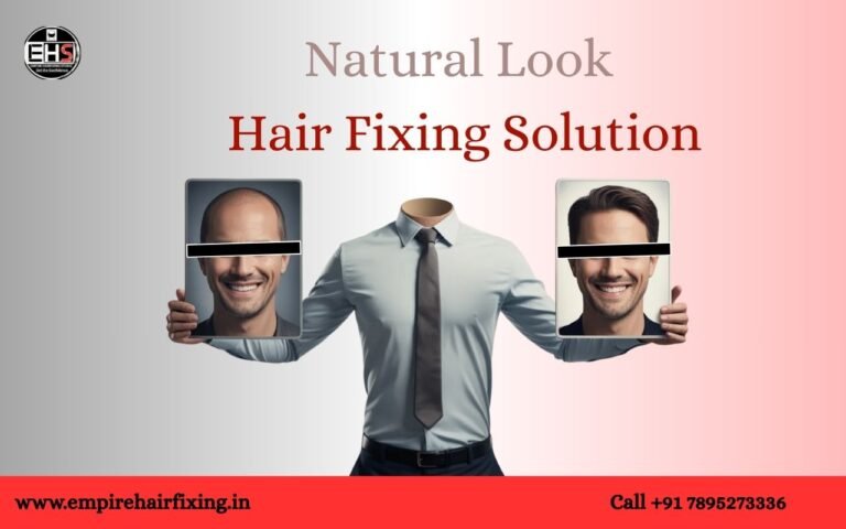 Top Benefits of Hair Replacement in 2026