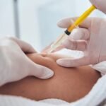 Lemon Bottle Injection: Shape Your Best Self