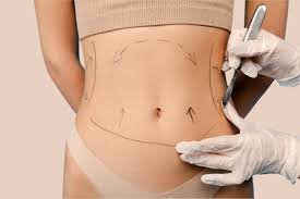 VASER Liposuction in Dubai: Precision Fat Removal Technology