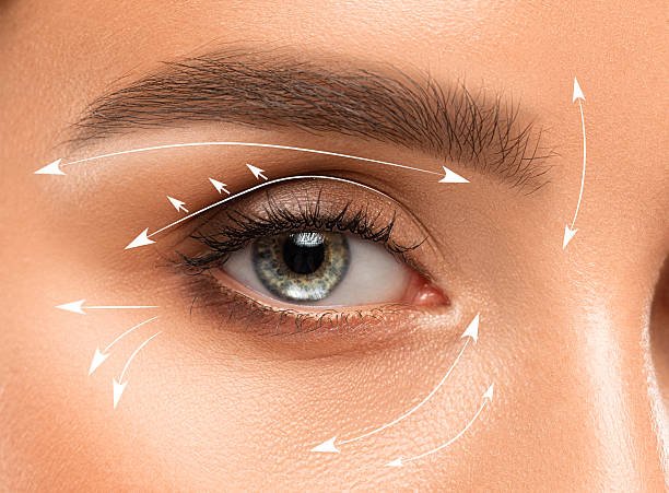 Eyelid Surgery in Islamabad: Subtle Enhancement for Brighter Eyes