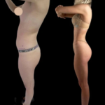 Best Doctors in Dubai Trusted for Cutting-Edge J-Plasma Technology