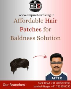 Hair Patch Care Tips: Make It Look Natural & Long-Lasting