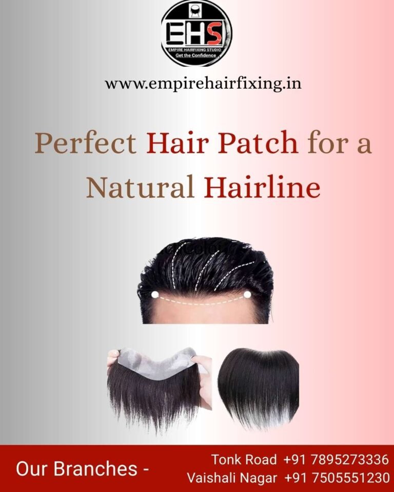 Why Hair Replacement Is More Popular Than Ever