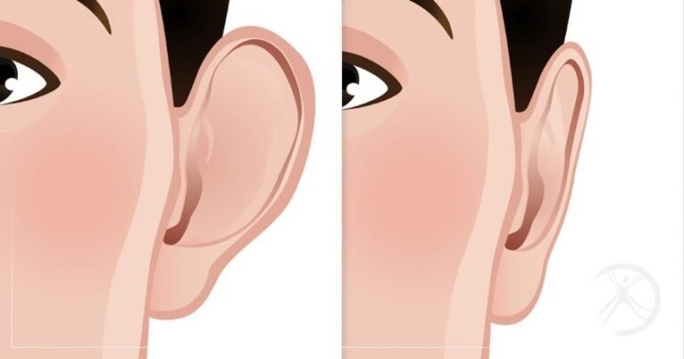 Ear Reshaping in Islamabad: Restore Confidence with Otoplasty