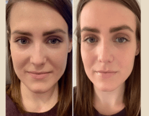 Best Doctors in Dubai Transforming Hair Growth with PRP Treatment