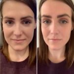 Best Aesthetic Clinic in Dubai for Expert-Guided PRP Injection