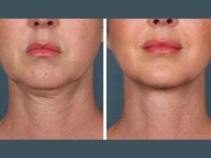 Best Plastic Surgeons in Dubai Driving Advanced PRP Treatment