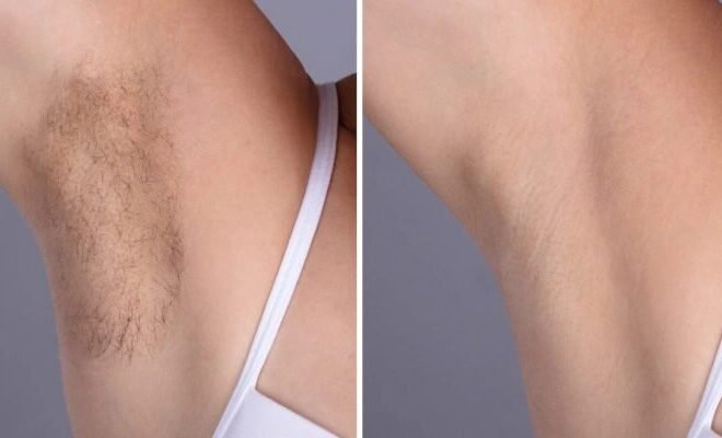 Best Plastic Surgeons in dubai: Laser Hair Removal Solutions