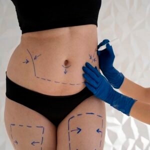 الاستعداد النفسي والجسدي لعملية شد البطن في الرياض