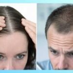 The entire Tutorial to help you Your hair Renovation: Procedures, Health benefits, and even Things Imagine