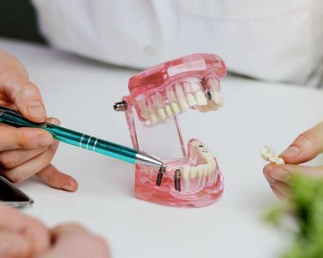 Cosmetic Prosthodontist Marketing: A Complete Guide to Growing Your Specialty Practice