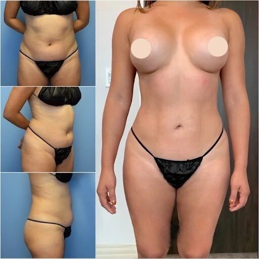 Best Body Contouring Surgeon in Dubai for Improved Body Definition