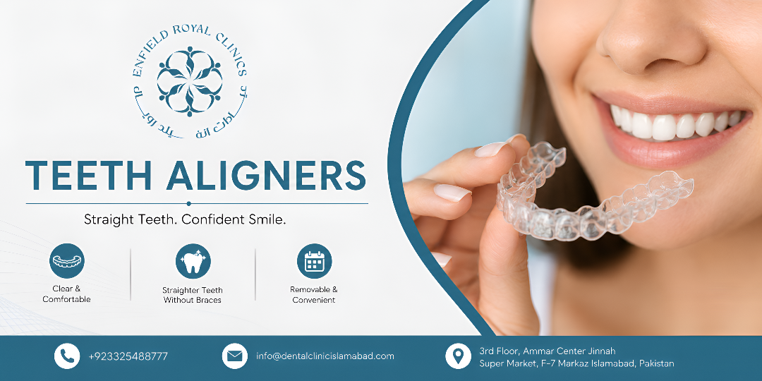 Teeth Aligners: A Modern Approach to Smile Correction