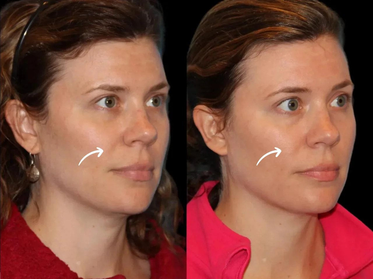 Best Plastic Surgeons in Dubai: Sculptra Medical History Checks